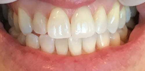 After case 04