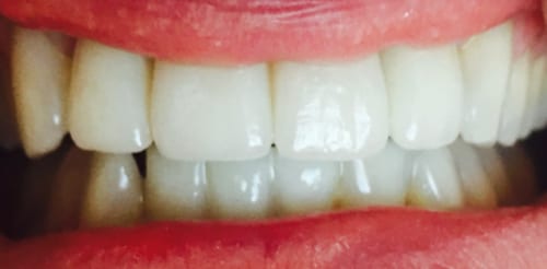 After case 05