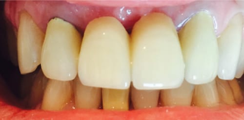 Before case 05