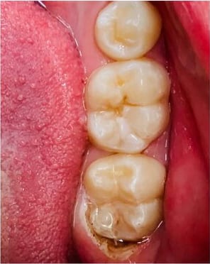 After case 09