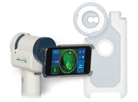 VELscope